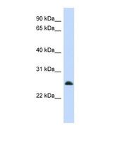 MRPL10 Antibody - Western blot of Human HepG2. MRPL10 antibody dilution 1.0 ug/ml.  This image was taken for the unconjugated form of this product. Other forms have not been tested.