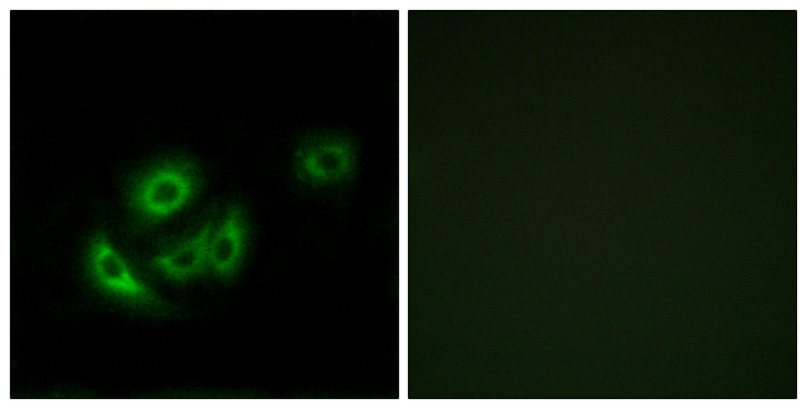 MRPL11 Antibody - Immunofluorescence analysis of A549 cells, using MRPL11 Antibody. The picture on the right is blocked with the synthesized peptide.
