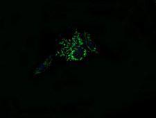 MRPL11 Antibody - Anti-MRPL11 mouse monoclonal antibody immunofluorescent staining of COS7 cells transiently transfected by pCMV6-ENTRY MRPL11.