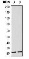 MRPL11 Antibody - Western blot analysis of MRPL11 expression in A431 (A); HepG2 (B) whole cell lysates.