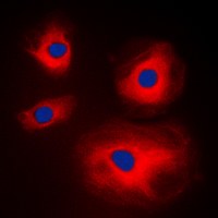 MRPL11 Antibody - Immunofluorescent analysis of MRPL11 staining in A431 cells. Formalin-fixed cells were permeabilized with 0.1% Triton X-100 in TBS for 5-10 minutes and blocked with 3% BSA-PBS for 30 minutes at room temperature. Cells were probed with the primary antibody in 3% BSA-PBS and incubated overnight at 4 C in a humidified chamber. Cells were washed with PBST and incubated with a DyLight 594-conjugated secondary antibody (red) in PBS at room temperature in the dark. DAPI was used to stain the cell nuclei (blue).