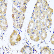 MRPL11 Antibody - Immunohistochemistry of paraffin-embedded human stomach tissue.
