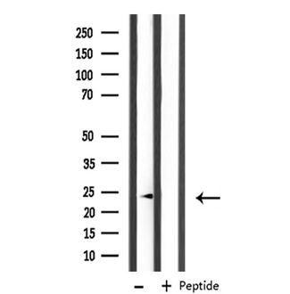 MRPL11 Antibody - Western blot analysis of extracts of COS cells using MRPL11 antibody.