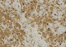 MRPL11 Antibody - 1:100 staining mouse muscle tissue by IHC-P. The sample was formaldehyde fixed and a heat mediated antigen retrieval step in citrate buffer was performed. The sample was then blocked and incubated with the antibody for 1.5 hours at 22°C. An HRP conjugated goat anti-rabbit antibody was used as the secondary.