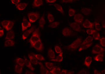 MRPL11 Antibody - Staining HeLa cells by IF/ICC. The samples were fixed with PFA and permeabilized in 0.1% Triton X-100, then blocked in 10% serum for 45 min at 25°C. The primary antibody was diluted at 1:200 and incubated with the sample for 1 hour at 37°C. An Alexa Fluor 594 conjugated goat anti-rabbit IgG (H+L) Ab, diluted at 1/600, was used as the secondary antibody.
