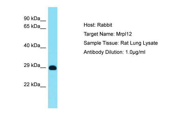 MRPL12 Antibody -  This image was taken for the unconjugated form of this product. Other forms have not been tested.