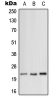 MRPL12 Antibody - Western blot analysis of MRPL12 expression in HeLa (A); SP2/0 (B); H9C2 (C) whole cell lysates.