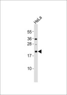 MRPL12 Antibody - Anti-MRPL12 Antibody at 1:1000 dilution + HeLa whole cell lysates Lysates/proteins at 20 ug per lane. Secondary Goat Anti-Rabbit IgG, (H+L),Peroxidase conjugated at 1/10000 dilution Predicted band size : 21 kDa Blocking/Dilution buffer: 5% NFDM/TBST.