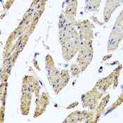 MRPL12 Antibody - Immunohistochemistry of paraffin-embedded human esophageal smooth muscle.