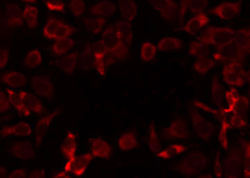 MRPL12 Antibody - Staining COLO205 cells by IF/ICC. The samples were fixed with PFA and permeabilized in 0.1% Triton X-100, then blocked in 10% serum for 45 min at 25°C. The primary antibody was diluted at 1:200 and incubated with the sample for 1 hour at 37°C. An Alexa Fluor 594 conjugated goat anti-rabbit IgG (H+L) Ab, diluted at 1/600, was used as the secondary antibody.