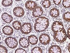 MRPL12 Antibody - Immunochemical staining of human MRPL12 in human colon with rabbit polyclonal antibody at 1:200 dilution, formalin-fixed paraffin embedded sections.
