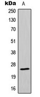 MRPL13 Antibody - Western blot analysis of MRPL13 expression in MCF7 (A) whole cell lysates.