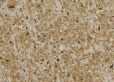 MRPL13 Antibody - 1:100 staining mouse muscle tissue by IHC-P. The sample was formaldehyde fixed and a heat mediated antigen retrieval step in citrate buffer was performed. The sample was then blocked and incubated with the antibody for 1.5 hours at 22°C. An HRP conjugated goat anti-rabbit antibody was used as the secondary.