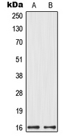 MRPL14 Antibody - Western blot analysis of MRPL14 expression in HeLa (A); HEK293 (B) whole cell lysates.
