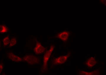 MRPL14 Antibody - Staining 293 cells by IF/ICC. The samples were fixed with PFA and permeabilized in 0.1% Triton X-100, then blocked in 10% serum for 45 min at 25°C. The primary antibody was diluted at 1:200 and incubated with the sample for 1 hour at 37°C. An Alexa Fluor 594 conjugated goat anti-rabbit IgG (H+L) Ab, diluted at 1/600, was used as the secondary antibody.