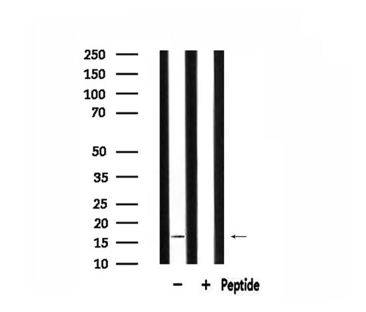 MRPL14 Antibody - Western blot analysis of extracts of 293 cells using MRPL14 antibody.