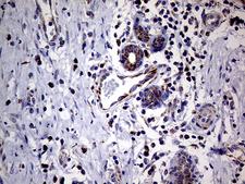 MRPL15 Antibody - Immunohistochemical staining of paraffin-embedded Human breast tissue within the normal limits using anti-MRPL15 mouse monoclonal antibody. (Heat-induced epitope retrieval by 1mM EDTA in 10mM Tris buffer. (pH8.5) at 120°C for 3 min. (1:500)