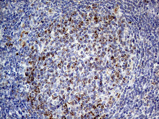 MRPL15 Antibody - Immunohistochemical staining of paraffin-embedded Human lymph node tissue within the normal limits using anti-MRPL15 mouse monoclonal antibody. (Heat-induced epitope retrieval by 1mM EDTA in 10mM Tris buffer. (pH8.5) at 120°C for 3 min. (1:500)