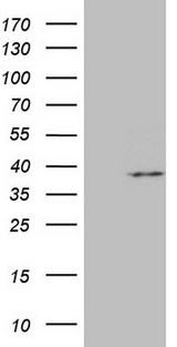 MRPL15 Antibody - HEK293T cells were transfected with the pCMV6-ENTRY control. (Left lane) or pCMV6-ENTRY MRPL15. (Right lane) cDNA for 48 hrs and lysed. Equivalent amounts of cell lysates. (5 ug per lane) were separated by SDS-PAGE and immunoblotted with anti-MRPL15.