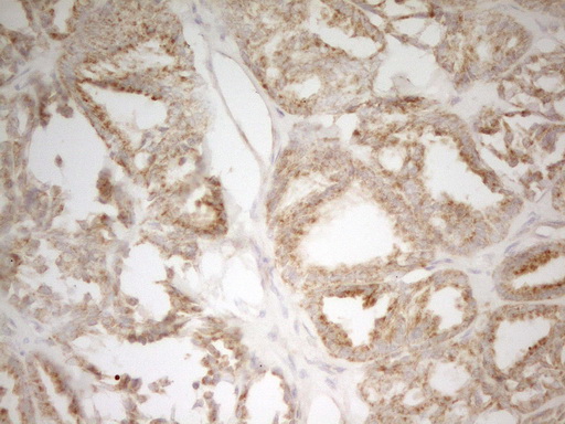 MRPL15 Antibody - IHC of paraffin-embedded Human thyroid tissue using anti-MRPL15 mouse monoclonal antibody. (Heat-induced epitope retrieval by 1 mM EDTA in 10mM Tris, pH8.5, 120°C for 3min).