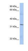 MRPL15 Antibody - MRPL15 antibody Western blot of PANC1 cell lysate. This image was taken for the unconjugated form of this product. Other forms have not been tested.