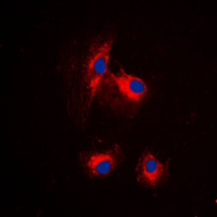 MRPL15 Antibody - Immunofluorescent analysis of MRPL15 staining in HUVEC cells. Formalin-fixed cells were permeabilized with 0.1% Triton X-100 in TBS for 5-10 minutes and blocked with 3% BSA-PBS for 30 minutes at room temperature. Cells were probed with the primary antibody in 3% BSA-PBS and incubated overnight at 4 C in a humidified chamber. Cells were washed with PBST and incubated with a DyLight 594-conjugated secondary antibody (red) in PBS at room temperature in the dark. DAPI was used to stain the cell nuclei (blue).