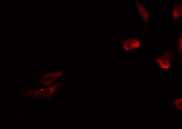 MRPL15 Antibody - Staining HeLa cells by IF/ICC. The samples were fixed with PFA and permeabilized in 0.1% Triton X-100, then blocked in 10% serum for 45 min at 25°C. The primary antibody was diluted at 1:200 and incubated with the sample for 1 hour at 37°C. An Alexa Fluor 594 conjugated goat anti-rabbit IgG (H+L) Ab, diluted at 1/600, was used as the secondary antibody.