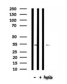 MRPL15 Antibody - Western blot analysis of extracts of 293 cells using MRPL15 antibody.