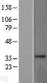 MRPL15 Protein - Western validation with an anti-DDK antibody * L: Control HEK293 lysate R: Over-expression lysate