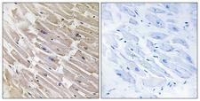 MRPL16 Antibody - Immunohistochemistry analysis of paraffin-embedded human heart tissue, using MRPL16 Antibody. The picture on the right is blocked with the synthesized peptide.