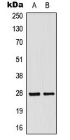 MRPL16 Antibody - Western blot analysis of MRPL16 expression in HepG2 (A); HeLa (B) whole cell lysates.