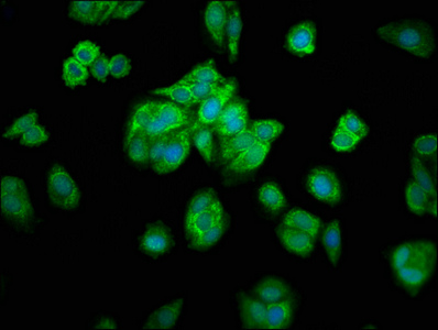 MRPL16 Antibody - Immunofluorescence staining of HepG2 cells with MRPL16 Antibody at 1:200, counter-stained with DAPI. The cells were fixed in 4% formaldehyde, permeabilized using 0.2% Triton X-100 and blocked in 10% normal Goat Serum. The cells were then incubated with the antibody overnight at 4°C. The secondary antibody was Alexa Fluor 488-congugated AffiniPure Goat Anti-Rabbit IgG(H+L).
