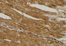 MRPL16 Antibody - 1:100 staining mouse muscle tissue by IHC-P. The sample was formaldehyde fixed and a heat mediated antigen retrieval step in citrate buffer was performed. The sample was then blocked and incubated with the antibody for 1.5 hours at 22°C. An HRP conjugated goat anti-rabbit antibody was used as the secondary.