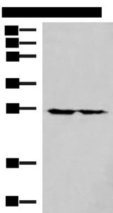 MRPL16 Antibody - Western blot analysis of 293T cell lysates  using MRPL16 Polyclonal Antibody at dilution of 1:800