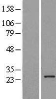MRPL16 Protein - Western validation with an anti-DDK antibody * L: Control HEK293 lysate R: Over-expression lysate