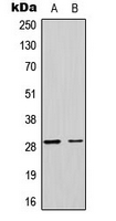 MRPL17 Antibody - Western blot analysis of MRPL17 expression in U251MG (A); HeLa (B) whole cell lysates.