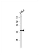 MRPL17 Antibody - Anti-MRPL17 Antibody at 1:1000 dilution + HeLa whole cell lysates Lysates/proteins at 20 ug per lane. Secondary Goat Anti-Rabbit IgG, (H+L),Peroxidase conjugated at 1/10000 dilution Predicted band size : 20 kDa Blocking/Dilution buffer: 5% NFDM/TBST.