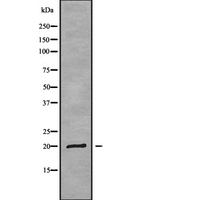 MRPL17 Antibody - Western blot analysis of MRPL17 using HuvEc whole cells lysates