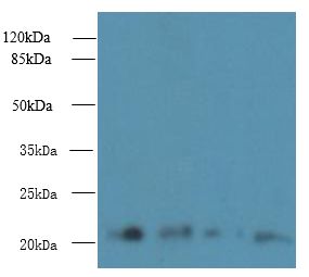 MRPL18 Antibody - Western blot. All lanes: MRPL18 antibody at 8 ug/ml. Lane 1: U251 whole cell lysate. Lane 2: Thp-1 whole cell lysate. Lane 3: PC-3 whole cell lysate. Lane 4: U87 whole cell lysate. Secondary antibody: Goat polyclonal to Rabbit IgG at 1:10000 dilution. Predicted band size: 21 kDa. Observed band size: 21 kDa.