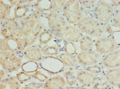 MRPL18 Antibody - Immunohistochemistry of paraffin-embedded human kidney tissue using antibody at dilution of 1:100.