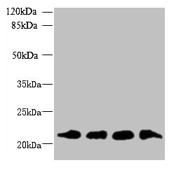 MRPL18 Antibody - Western blot All lanes: MRPL18 antibody at 8µg/ml Lane 1: U251 whole cell lysate Lane 2: THP-1 whole cell lysate Lane 3: PC-3 whole cell lysate Lane 4: U87 whole cell lysate Secondary Goat polyclonal to rabbit IgG at 1/10000 dilution Predicted band size: 21 kDa Observed band size: 21 kDa