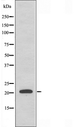 MRPL18 Antibody - Western blot analysis of extracts of HT29 cells using MRPL18 antibody.
