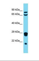 MRPL18 Antibody - Western blot of Human THP-1. MRPL18 antibody dilution 1.0 ug/ml.  This image was taken for the unconjugated form of this product. Other forms have not been tested.