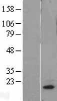 MRPL18 Protein - Western validation with an anti-DDK antibody * L: Control HEK293 lysate R: Over-expression lysate