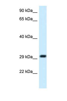 MRPL19 Antibody - MRPL19 antibody Western blot of Fetal Liver lysate. Antibody concentration 1 ug/ml.  This image was taken for the unconjugated form of this product. Other forms have not been tested.