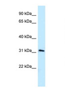 MRPL19 Antibody - MRPL19 antibody Western blot of A549 Cell lysate. Antibody concentration 1 ug/ml.  This image was taken for the unconjugated form of this product. Other forms have not been tested.