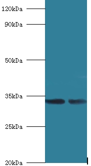 MRPL19 Antibody - Western blot of 39S ribosomal protein L19, mitochondrial antibody at 2 ug/ml lane 1: MCF-7 whole cell lysate lane 2: mouse liver tissue.  This image was taken for the unconjugated form of this product. Other forms have not been tested.