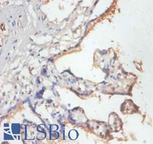 MRPL19 Antibody - Immunohistochemistry of paraffin-embedded human placenta using MRPL19 antibody at dilution of 1:50.  This image was taken for the unconjugated form of this product. Other forms have not been tested.