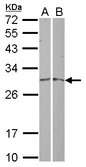 MRPL19 Antibody - Sample (30 ug of whole cell lysate) A: A431 B: Raji 12% SDS PAGE MRPL19 antibody diluted at 1:1000