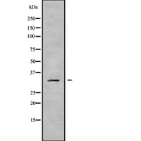 MRPL19 Antibody - Western blot analysis of MRPL19 using Jurkat whole cells lysates